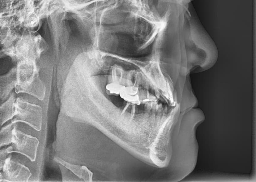 Maxillofacial